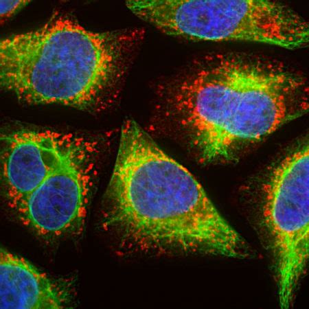 Endosome, Lysosome, Peroxisome Marker Antibody Panel (Catalase, Caveolin1, Clathrin heavy chain ...