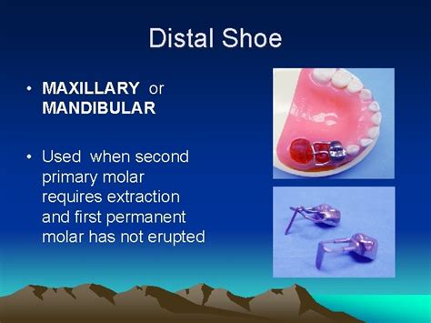 Basic Space Maintainers lecture one Prepared by Dr