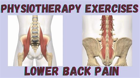 Physiotherapy Exercises for Lower Back Pain