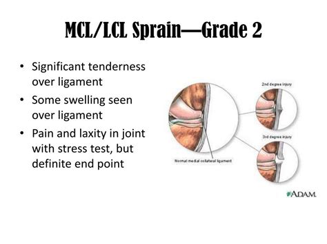 PPT - The Knee PowerPoint Presentation, free download - ID:2139558