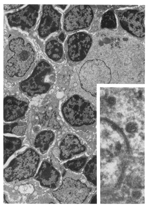 Germinal center. Dendritic cell processes (arrow) with images... | Download Scientific Diagram