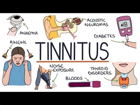 What is Tinnitus? Tributes pour in as Ian Punnett of Coast to Coast AM ...