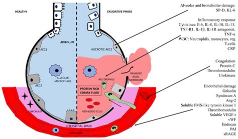 Pathophysiology Of Ards