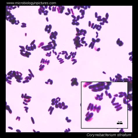 Corynebacterium striatum microscopy. Diphtheroids micrograph. Corynebacterium striatum ...