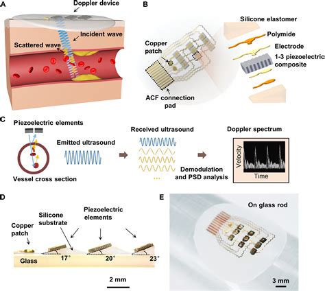 Monitoring blood flow velocity with a flexible Doppler ultrasound device