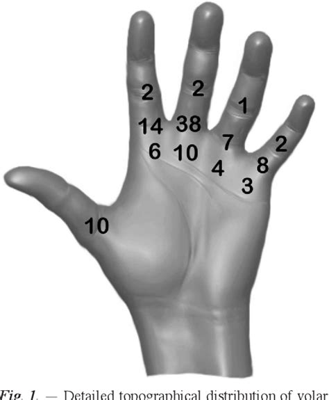 Figure 1 from Volar retinacular ganglions (flexor tendon sheath ...