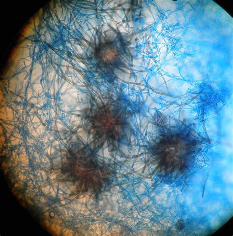 ATLAS MICOLOGIA: CHAETOMIUM SPECIES