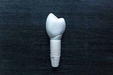 Ceramic Dental Implants - Atlanta Periodontics