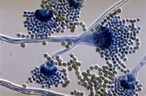 Aspergillus flavus under microscope | Medical Laboratories