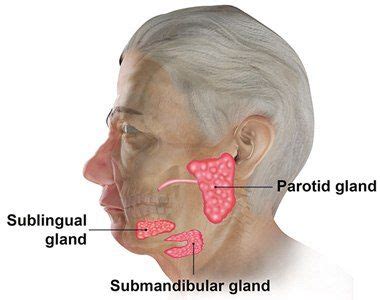 Submandibular Salivary Gland Surgery Melbourne | Sublingual Gland Melbourne