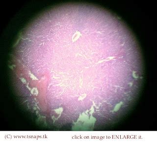 Histology Slides Database: Liver histology slides