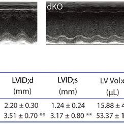 Assessment of left ventricle systolic function by echocardiography. (A)... | Download Scientific ...