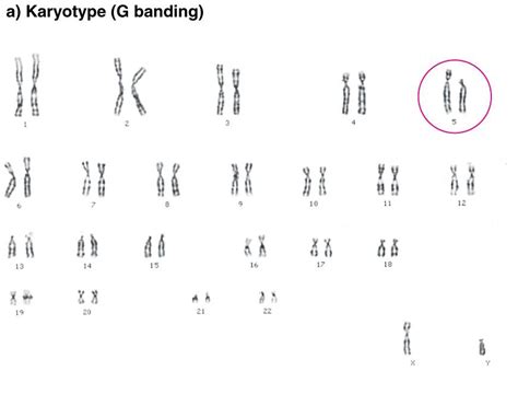 Euploid karyotypes