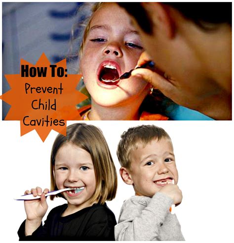 Tips To Prevent Cavities In Children | Cavities in kids