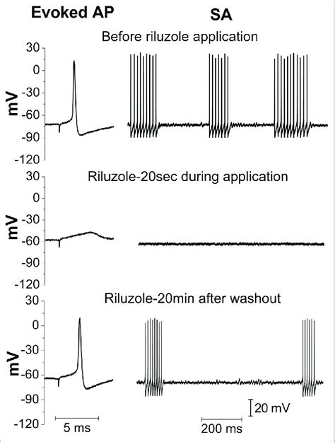 Example of Riluzole Effects on A Spontaneously Burst Firing Aβ Cell ...