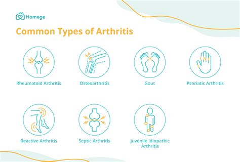 Arthritis 101: Causes, Symptoms, Types and Treatment - Homage