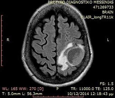 List 105+ Pictures Where Is The Parietal Lobe In The Brain Excellent