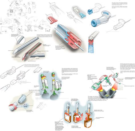 Safety System for Intrathecal Drug Delivery by Greg Browne at Coroflot.com