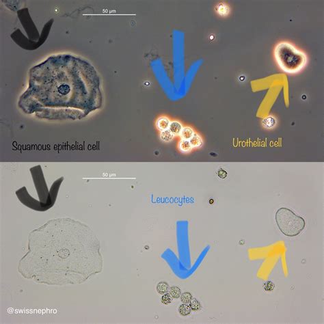 Urine Sediment Cells