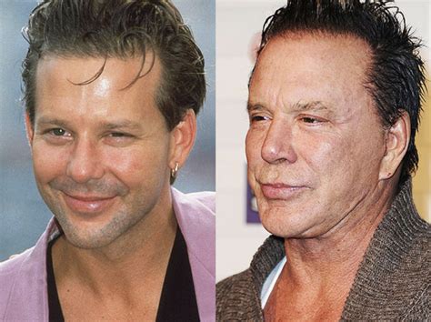 Mickey Rourke's Face Is Destroyed by Too Many Botched Plastic Surgeries - Demotix.com