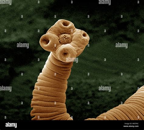 Tapeworm Under A Microscope