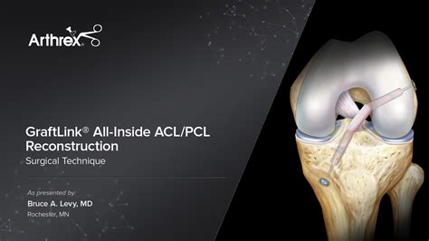 Arthrex - GraftLink® All-Inside ACL/PCL Reconstruction