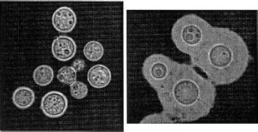 Cryptococcus: Species, Symptoms, Infection and Treatment | Mold Busters