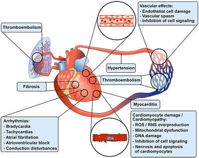 Frontiers | Antineoplastic Drug-Induced Cardiotoxicity: A Redox Perspective