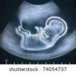 Ultrasound And Belly Free Stock Photo - Public Domain Pictures