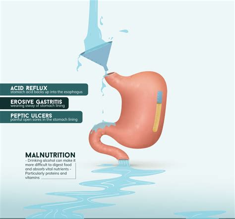 The Effects of Alcohol on the Body Full-Page Infographic