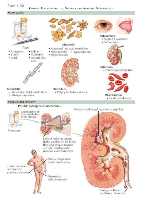 Pin on Urinary System