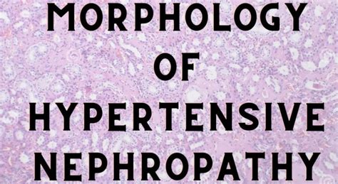 Hypertensive Nephropathy: A Silent Threat to Your Kidney Health