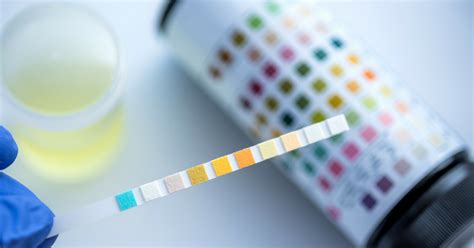 Urinalysis: How to Interpret Your Results | GMP Medical | Hialeah, Florida