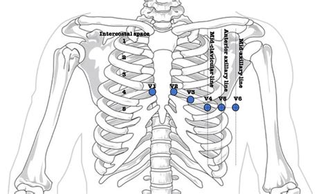 6: Precordial electrodes placement on the thorax to perform a standard... | Download Scientific ...