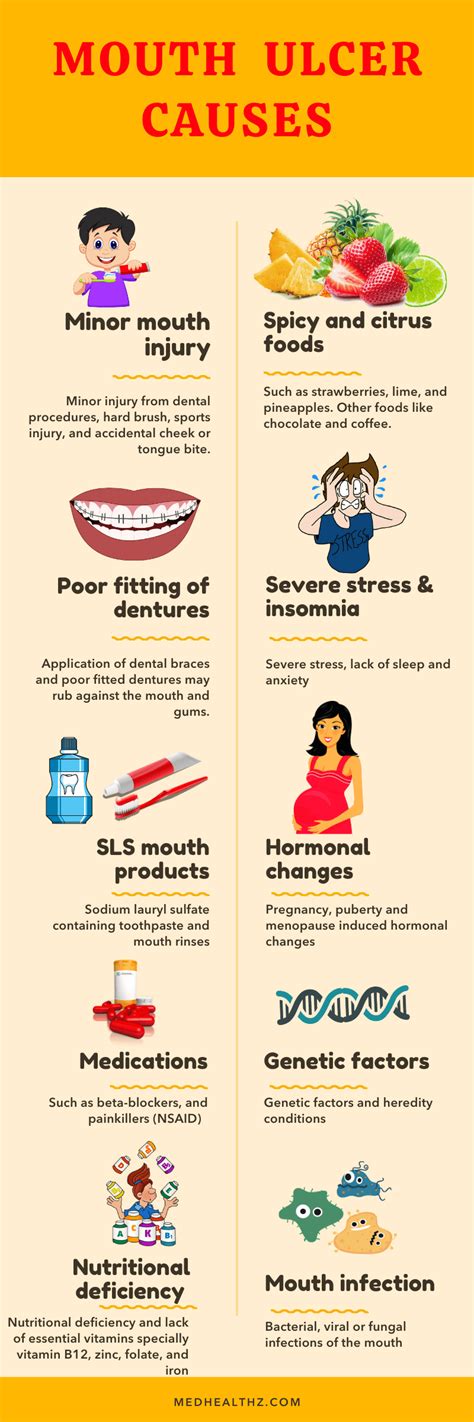 CAUSES OF MOUTH ULCER in 2020 | Mouth ulcers, Ulcers, Causes of mouth ...