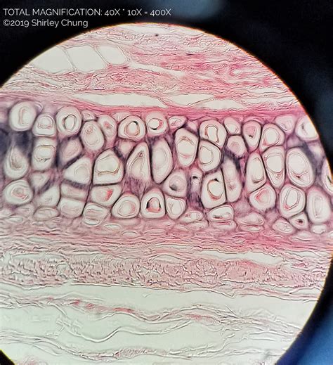 B. C2-ELASTICCARTILAGE – Histology