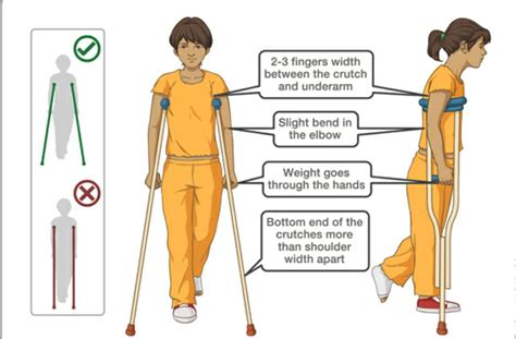 How to Use Crutches: 7 Steps (with Pictures) - wikiHow | Crutches, Nursing mnemonics, Basic ...