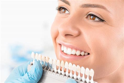 Dental Veneers: What to Expect During Your Veneers Procedure - Silver ...