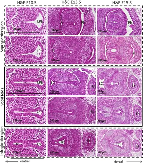 Vocalis Muscle Histology