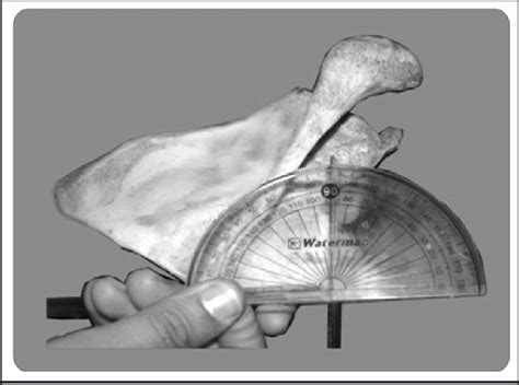 Measurement of Superior Angle. | Download Scientific Diagram