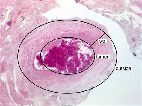 Histology of the arterial vessel showing the size of the lumen compared ...