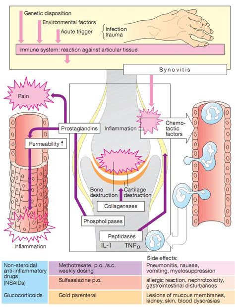 DMARDS in the treatment of rheumatoid arthritis – Medchrome