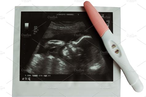 Ultrasound picture of baby with pregnancy test ~ Health Photos ...