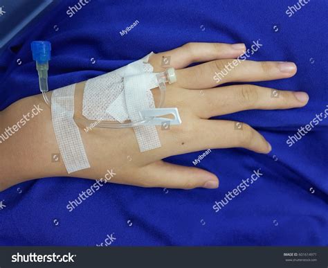 Female Hand Iv Drip Needle Stock Photo 601614971 - Shutterstock