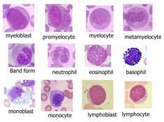 myelocyte metamyelocyte - Google Search | Medical technology ...