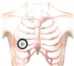 Crackles - Coarse (Rales) | Auscultation #31 | Lesson with Audio