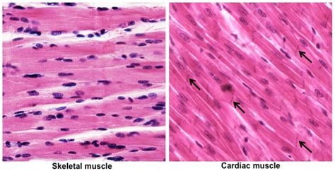 Skeletal Muscle And Cardiac Muscle