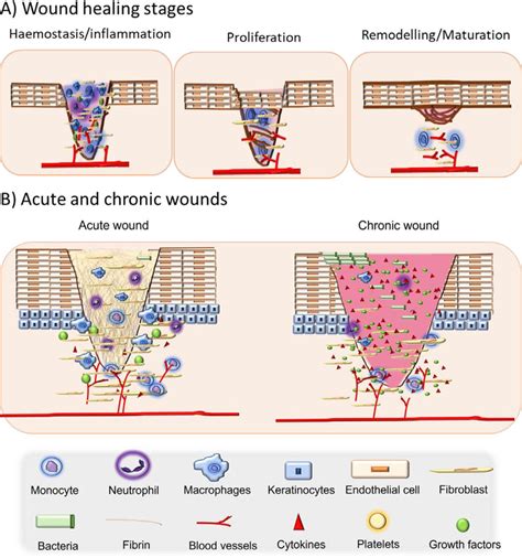 A) Wound healing stages: haemostasis and inflammation, proliferation ...