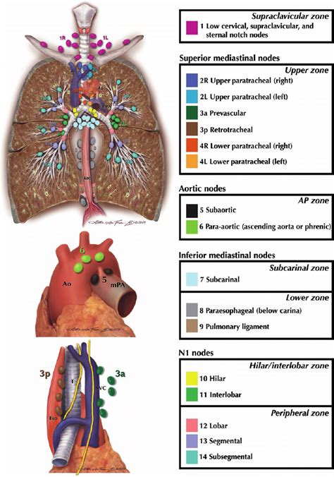 The IASLC lymph node map including the proposed grouping of lymph node... | Download Scientific ...