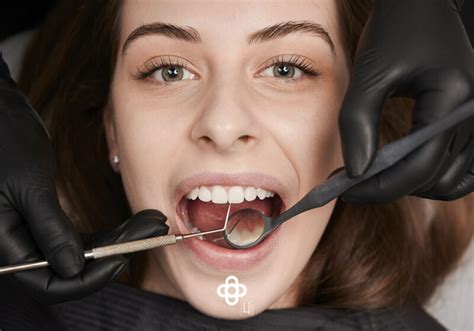 ¿En qué consiste una limpieza dental profunda? - 4ces